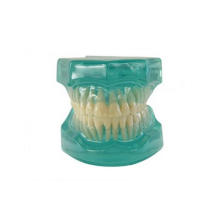 TM-B7 Clear Model Showing Dentition After Orthodontic Treatment